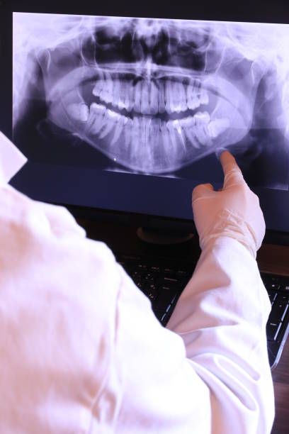 Best Emergency Denture Repair in Lus Valley Marinwood, CA